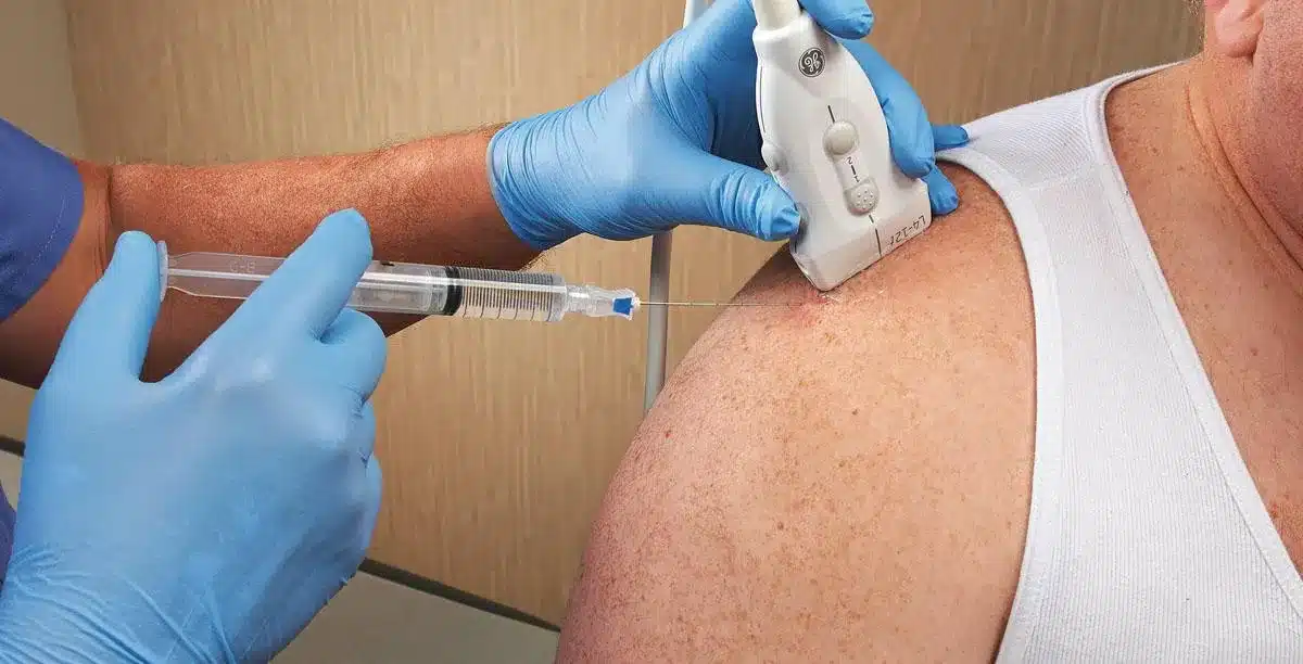 Ultrasound Guided Injections