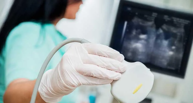 A sonographer is holding an ultrasound probe looking at the ultrasound scanner