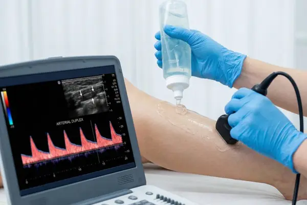 Arterial duplex ultrasound scan on a patient&rsquo;s leg