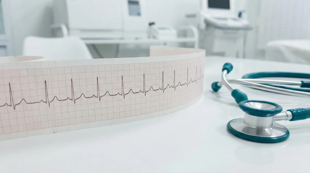 Clinical ECG trace printout