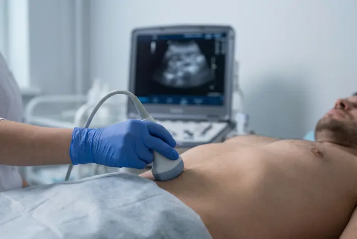 Ultrasound scan of an inguinal hernia in the groin